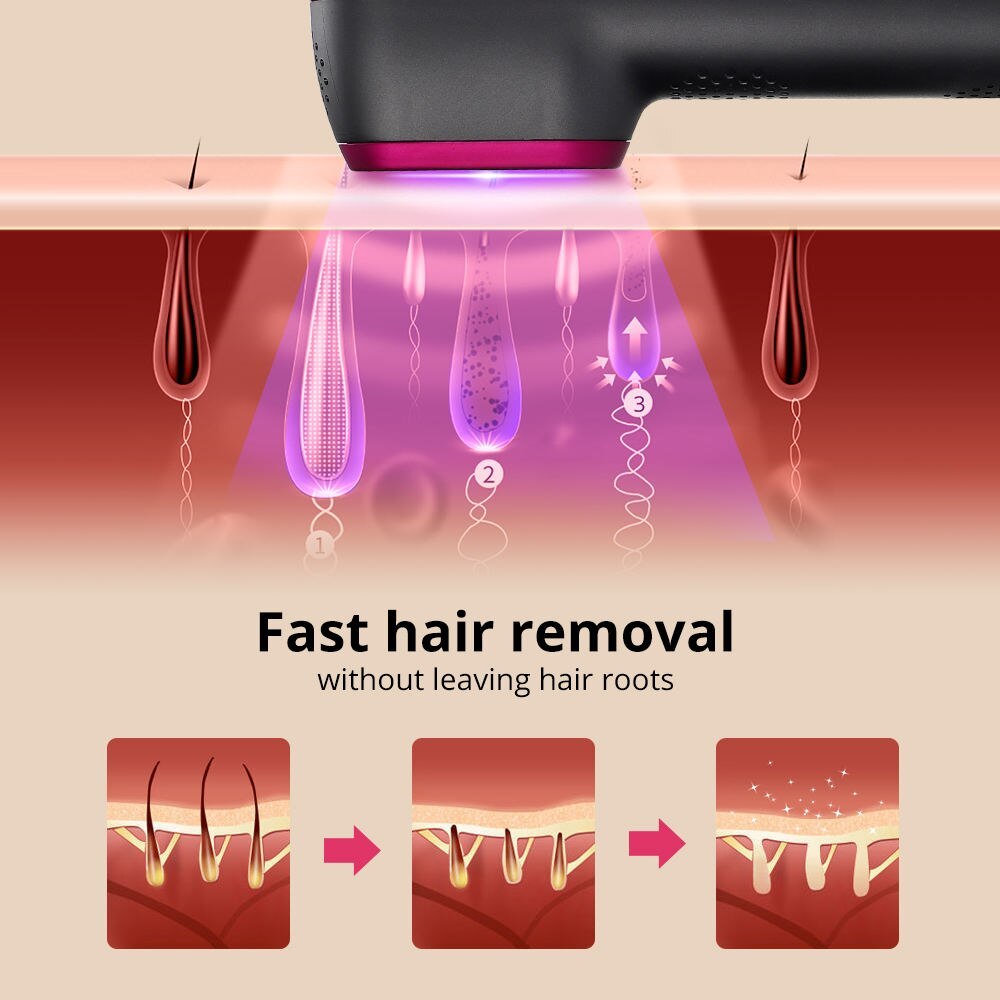 IPL Hair Removal Device for Home – 5-Speed Pulse Light Painless Laser